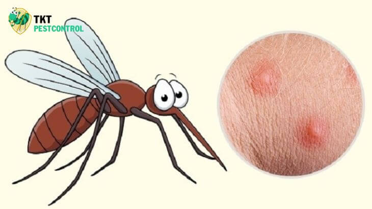 Image: Mosquito bites